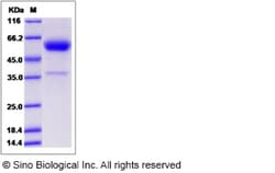 Sino Biological Rat CD153 / CD30L / TNFSF8 Protein (Fc Tag) 100ug, Quantity: