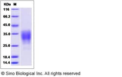 Sino Biological Recombinant Rat CD30 Ligand/TNFSF8 Protein, Quantity: Each