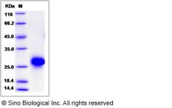 Sino Biological Recombinant Rat CD40/TNFRSF5 Protein (His Tag), HPLC-verified,