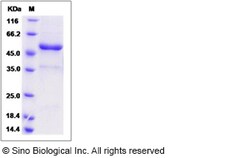 Sino Biological Recombinant Rat TWEAK/TNFSF12 Protein (hFc Tag), Quantity: