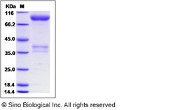 Sino Biological Rat TNFRSF21 / DR6 Protein (Fc Tag) 50ug, Quantity: Each