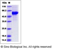 Sino Biological Rat CD70 / CD27L / TNFSF7 Protein (Fc Tag) 100ug, Quantity: