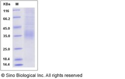 Sino Biological Recombinant Rat 4-1BB Ligand/TNFSF9 Protein (His Tag),