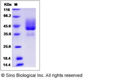 Sino Biological Recombinant Rat BAFFR/TNFRSF13C Protein (hFc Tag), Quantity: