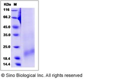 Sino Biological Recombinant Rat BAFFR/TNFRSF13C Protein (His Tag), Quantity:
