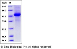 Sino Biological Rat IFNA4 / IFNα4 / Interferon alpha-4 Protein (Fc Tag)