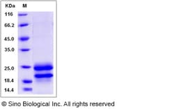 Sino Biological Recombinant Rat Interferon alpha 1/IFNA1 Protein (His Tag),