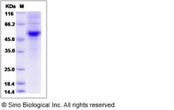 Sino Biological Recombinant Rat CD40 Ligand/TNFSF5 Protein (hFc Tag), Quantity: