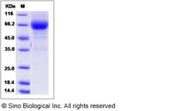 Sino Biological Recombinant Rat Lymphotoxin-beta receptor/TNFRSF3 Protein