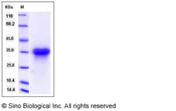 Sino Biological Recombinant Rat Lymphotoxin-beta receptor/TNFRSF3 Protein