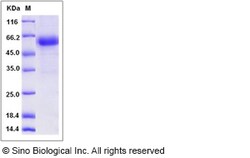 Sino Biological Recombinant Rat TNFR1/CD120a Protein (hFc Tag), Quantity: