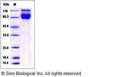 Sino Biological Recombinant Rat IFNGR1 Protein (hFc Tag), Quantity: Each