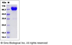 Sino Biological Recombinant Rat IL-10RB/IL-10R beta Protein (hFc Tag),