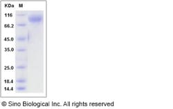 Sino Biological Recombinant Rat IL-13 R alpha 1/IL13RA1 Protein (hFc Tag),