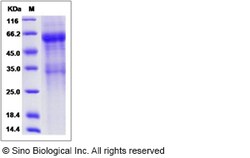 Sino Biological Recombinant Rat IL-20R beta/IL-20RB Protein (hFc Tag),