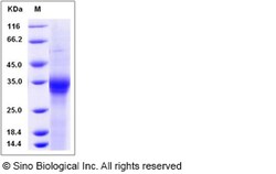 Sino Biological Recombinant Rat IL-20R beta/IL-20RB Protein (His Tag),