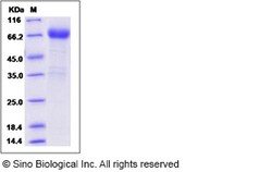 Sino Biological Recombinant Rat IL-21 Receptor/IL-21R Protein (mFc Tag),