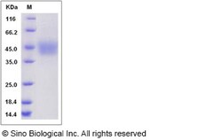 Sino Biological Recombinant Rat IL-21 Receptor/IL-21R Protein (His Tag),