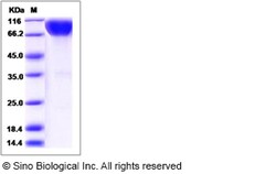 Sino Biological Rat IL17RA / IL17R Protein (Fc Tag) 100ug, Quantity: Each