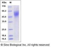 Sino Biological Recombinant Rat IL-17RA Protein (His Tag), Quantity: Each