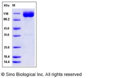 Sino Biological Rat IL18R1 Protein (Fc Tag) 100ug, Quantity: Each of 1
