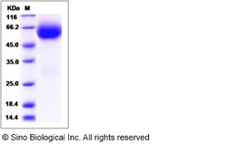 Sino Biological Recombinant Rat IL-18Rα Protein (His Tag), Quantity: Each
