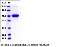 Sino Biological Rat GITR / TNFRSF18 Protein (Fc Tag) 100ug, Quantity: Each