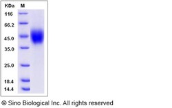 Sino Biological Recombinant Rat IL-2R gamma/CD132 Protein (His Tag), Quantity: