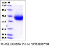 Sino Biological Recombinant Rat IL-4R Protein (His Tag), HPLC-verified,