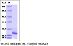 Sino Biological Rat IL21 / Interleukin 21 Protein (His Tag) 100ug, Quantity: