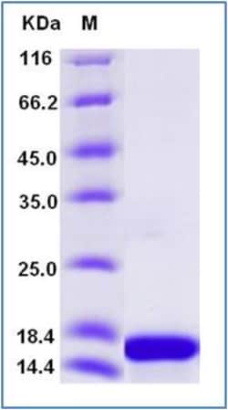 Sino Biological Rat IL-21 Protein 20ug, Quantity: Each of 1