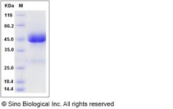 Sino Biological Rat IL13RA2 / IL13R Protein (His Tag) 100ug, Quantity: