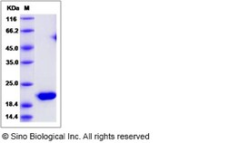 Sino Biological Recombinant Rat interferon-alpha/IFNA5 Protein (His Tag),