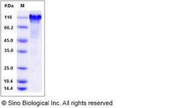 Sino Biological Recombinant Rat C1qR1/CD93 Protein (His Tag), HPLC-verified,