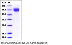 Sino Biological Recombinant Rat CLEC4F Protein, Quantity: Each of 1