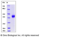 Sino Biological Rat CADM3 / NECL1 / IGSF4B Protein (His Tag) 100ug, Quantity: