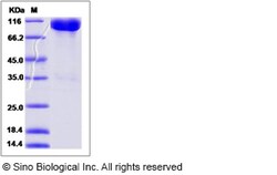 Sino Biological Recombinant Rat CD166/ALCAM Protein (hFc Tag), Quantity: