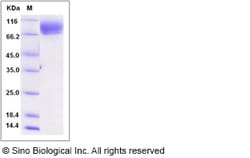 Sino Biological Recombinant Rat CD166/ALCAM Protein (His Tag), Quantity: