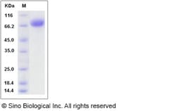 Sino Biological Rat BCAM Protein (His Tag) 100ug, Quantity: Each of 1