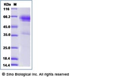Sino Biological Recombinant Rat CD27/TNFRSF7 Protein (hFc Tag), Quantity: