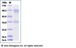 Sino Biological Recombinant Rat CD27/TNFRSF7 Protein (mFc Tag), Quantity: