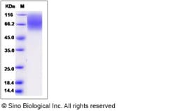 Sino Biological Recombinant Rat CEACAM-1/CD66a Protein (His Tag), Quantity: