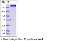 Sino Biological Recombinant Rat LAMP1 Protein (hFc Tag), Quantity: Each