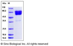Sino Biological Recombinant Rat EDAR Protein (hFc Tag), Quantity: Each