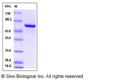 Sino Biological Rat Galectin-8 / LGALS8 Protein (GST Tag) 100ug, Quantity: