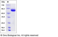 Sino Biological Recombinant Rat JAM-A/F11 Receptor Protein (hFc Tag), Quantity: