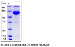 Sino Biological Recombinant Rat ESAM Protein (hFc Tag), Quantity: Each