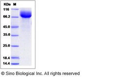 Sino Biological Recombinant Rat HEPACAM2 Protein (hFc Tag), Quantity: Each