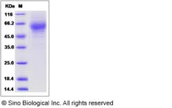 Sino Biological Recombinant Rat HEPACAM2 Protein (His Tag), Quantity: Each