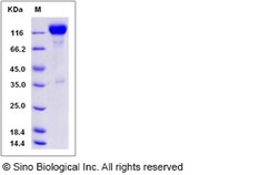 Sino Biological Recombinant Rat TrkB Protein (hFc Tag), Quantity: Each